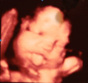 Fetuses make all sorts of facial expressions as early as 14 weeks.
