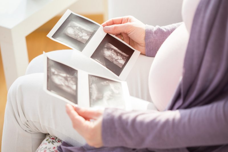 Prenatal Tests 101: Things To Consider When Deciding On Prenatal Tests