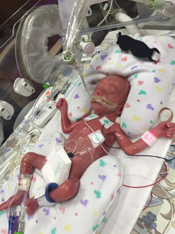 Family celebrates health and happiness as twins turn 1